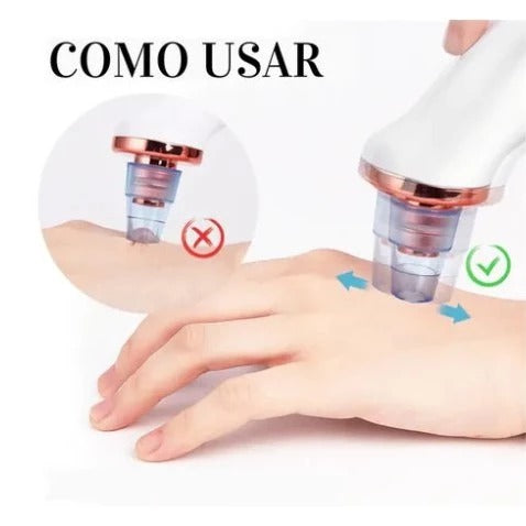 Máquina de Sucção Remove Cravos e Espinhas